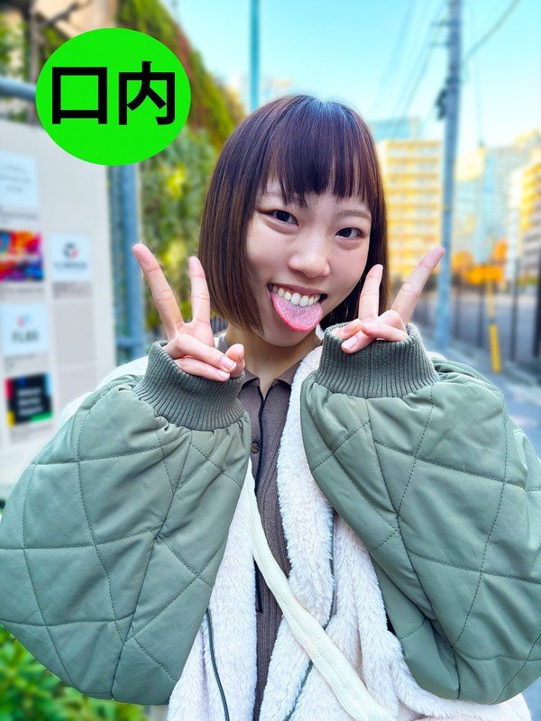 街角で声をかけて口内観察させてもらう オーガニックスーパー勤務 はつみちゃん - ペロネ - h_1651nko0300003