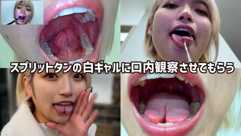 街角で声をかけて口内観察させてもらう 美容部員 はるのちゃん - ペロネ - h_1651nko0500001 - 素人AV女優判定AI